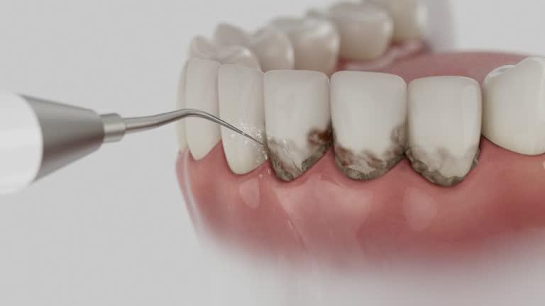 Reliable Emergency Dentist contractor in Millbrook, AL by Smile Center Dentistry